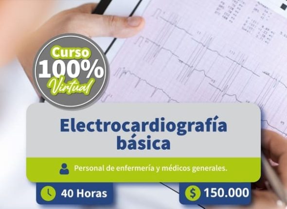 Electrocardiografía básica - General